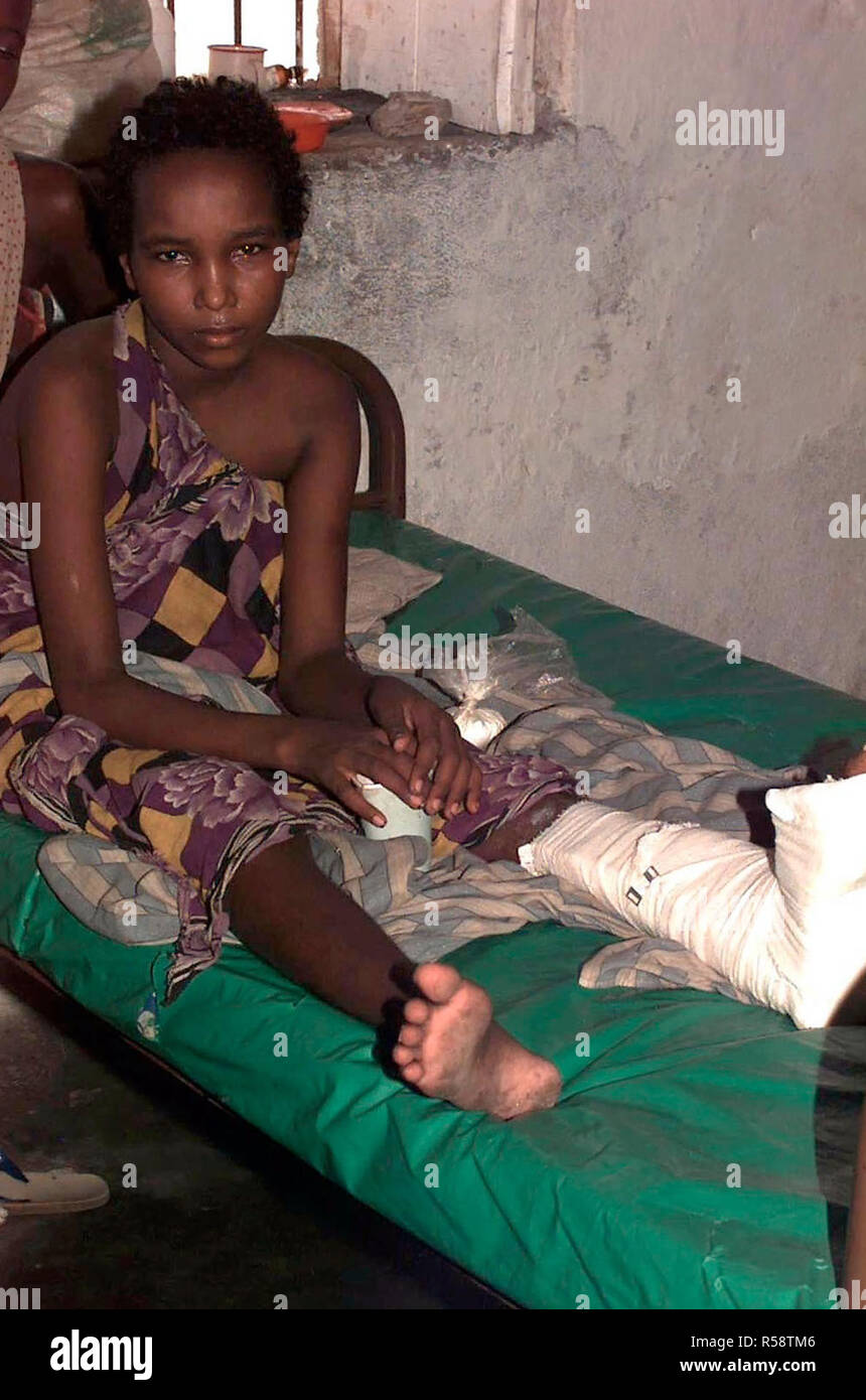 1993 - una joven muchacha somalí se sienta en una cama frente a la cámara. Ella tiene vendas y una férula de yeso en su pierna izquierda. Ella está recuperándose de una herida de bala que recibió cuando ella estaba en las cercanías de un raid en un convoy de abastecimiento de la ONU por bandidos fuera de Bardera, Somalia. Fue tratada y se está recuperando en el hospital de Bardera. Esta misión está en apoyo directo de la operación Restaurar la esperanza. Foto de stock