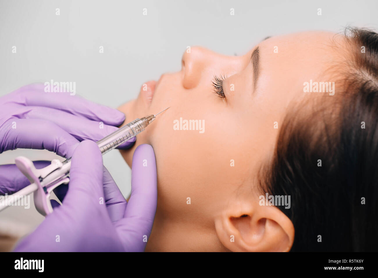 Una mujer con inyecciones facial para lifting facial y efecto anti-envejecimiento Foto de stock