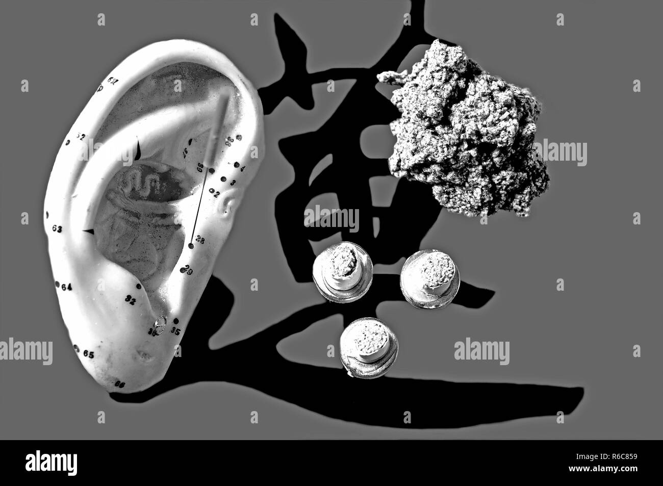 Aguja de acupuntura de oreja Fotografía de stock - Alamy