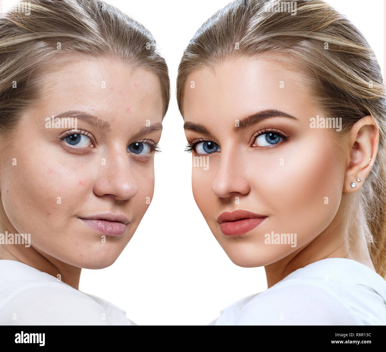 Mujer joven antes y después del tratamiento para la piel y maquillaje  Fotografía de stock - Alamy