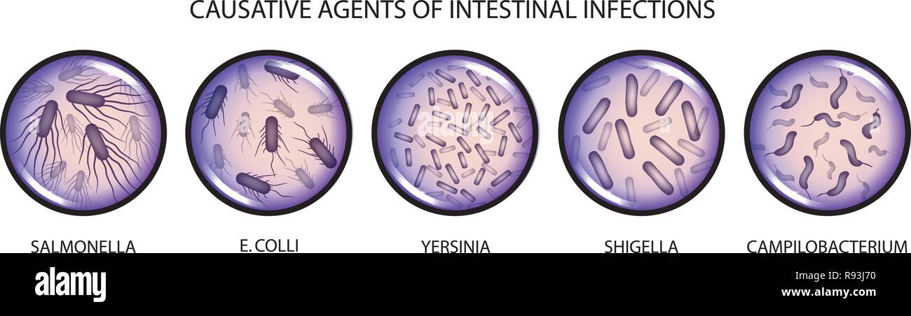 Ilustración vectorial de los agentes causantes de infecciones intestinales Ilustración del Vector
