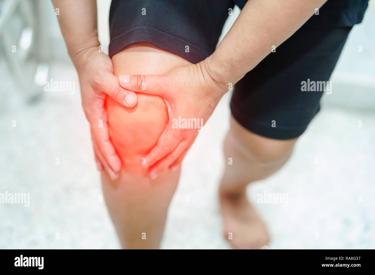 Asia dama de mediana edad paciente tocar y sentir el dolor de la rodilla : concepto médico sano. Foto de stock