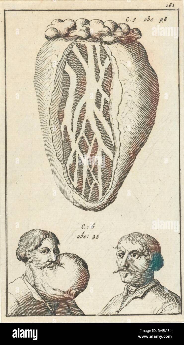 Imagen anatómica XIV, Jan Luyken, Jan Claesz diez Hoorn, 1680: 168). Reimagined by Gibon. Arte clásico con un moderno reinventado Foto de stock