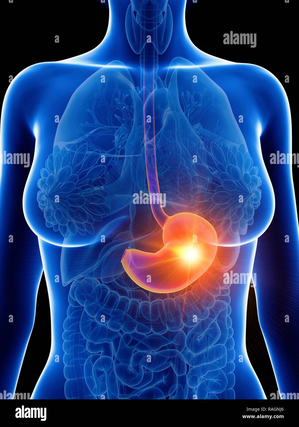 beneficio Aprendizaje atmósfera vaso del estomago inflamado Tres algo