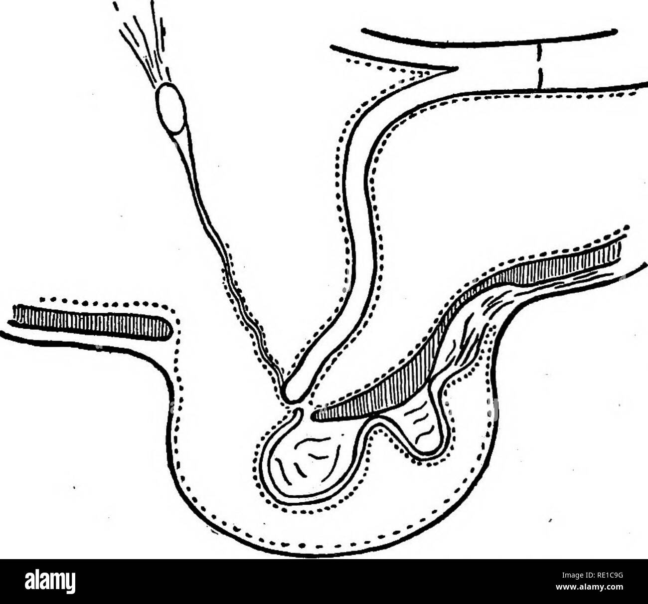 Enfermedades Quirúrgicas y Cirugía del perro. Los perros. Nº 61. Diagrama que ilustra la posición normal de las piezas. Diagrama que ilustra el mecanismo de hernia inguinal. Por favor