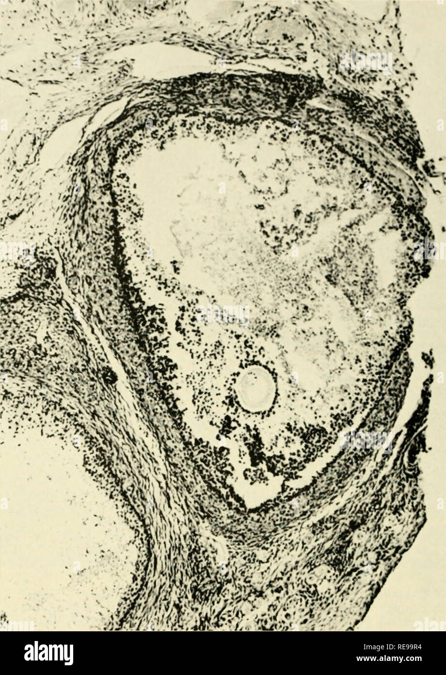 . Control de la ovulación; actas de la conferencia celebrada en la Casa de Endicott, Dedham, Massachusetts, 1960. - La regulación de la ovulación. Fig. 2. Dos o más folículos en el ovario de la misma monkey mostrada en la Fig. 1. Estos miden aproximadamente mil micra de diámetro. A pesar de que el óvulo es relativamente intactos, la disolución de la granulosa es evidente. La teca interna tanto en estos folículos de la segunda hilera es marcadamente engrosada.. Por favor tenga en cuenta que estas imágenes son extraídas de la página escaneada imágenes que podrían haber sido mejoradas digitalmente para mejorar la legibilidad, la coloración y el aspecto de estos illustrat Foto de stock