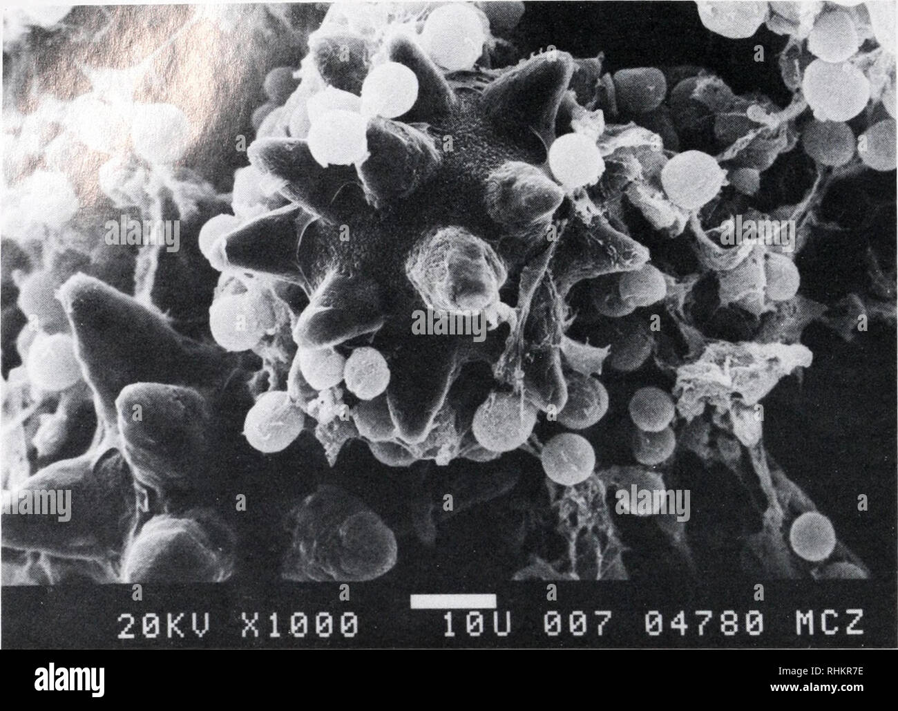 . El boletín biológica. La Biología, Zoología; biología; biología marina. 66 R.R. OLSON. Figura 3. Micrografía electrónica de espículas calcáreas, estrellado y Synechocystis algas (pequeñas esferas) en la túnica de T. solidum. La parte superior de la foto es la parte superior de la colonia. (Foto por E. Seling.) sin el peso seco libre de cenizas (peso seco/peso seco total) de 13,28 D.E. = 1,42; n = 9) y 15,46 (D.S. = 1,52; n = 9), respectivamente. Así la luz colonias tienen una significativamente mayor componente inorgánico (MEST, P &LT; 0,01). Esta diferencia se refleja también en la relación de volumen a peso seco (Cuadro I) que muestra Foto de stock