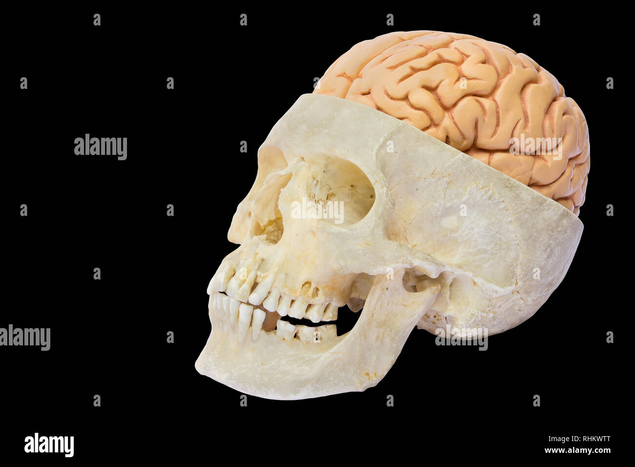 Cráneo humano con modelo de cerebro aislado sobre fondo negro Foto de stock