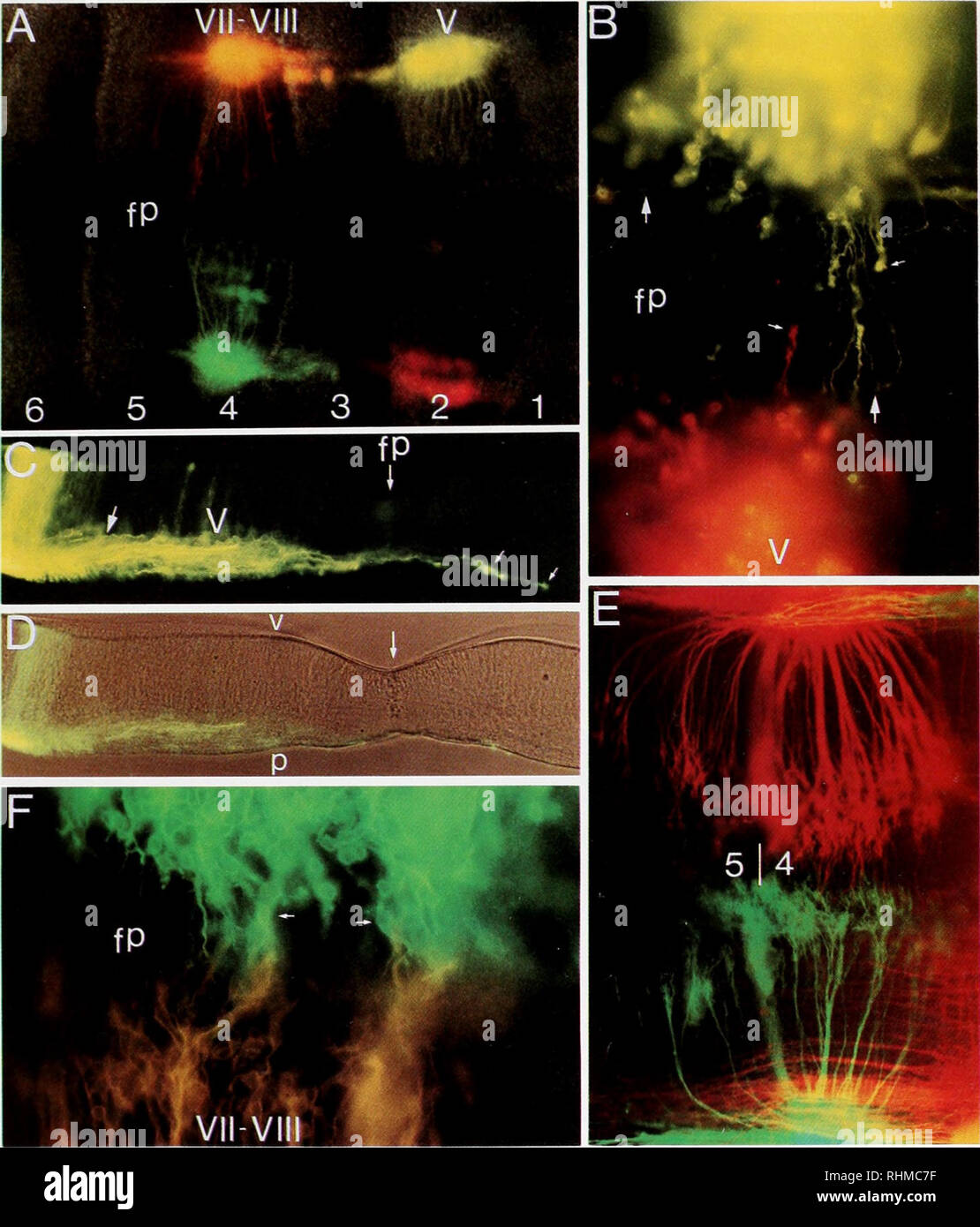 Micrografía de epifluorescencia fotografías e imágenes de alta resolución -  Alamy