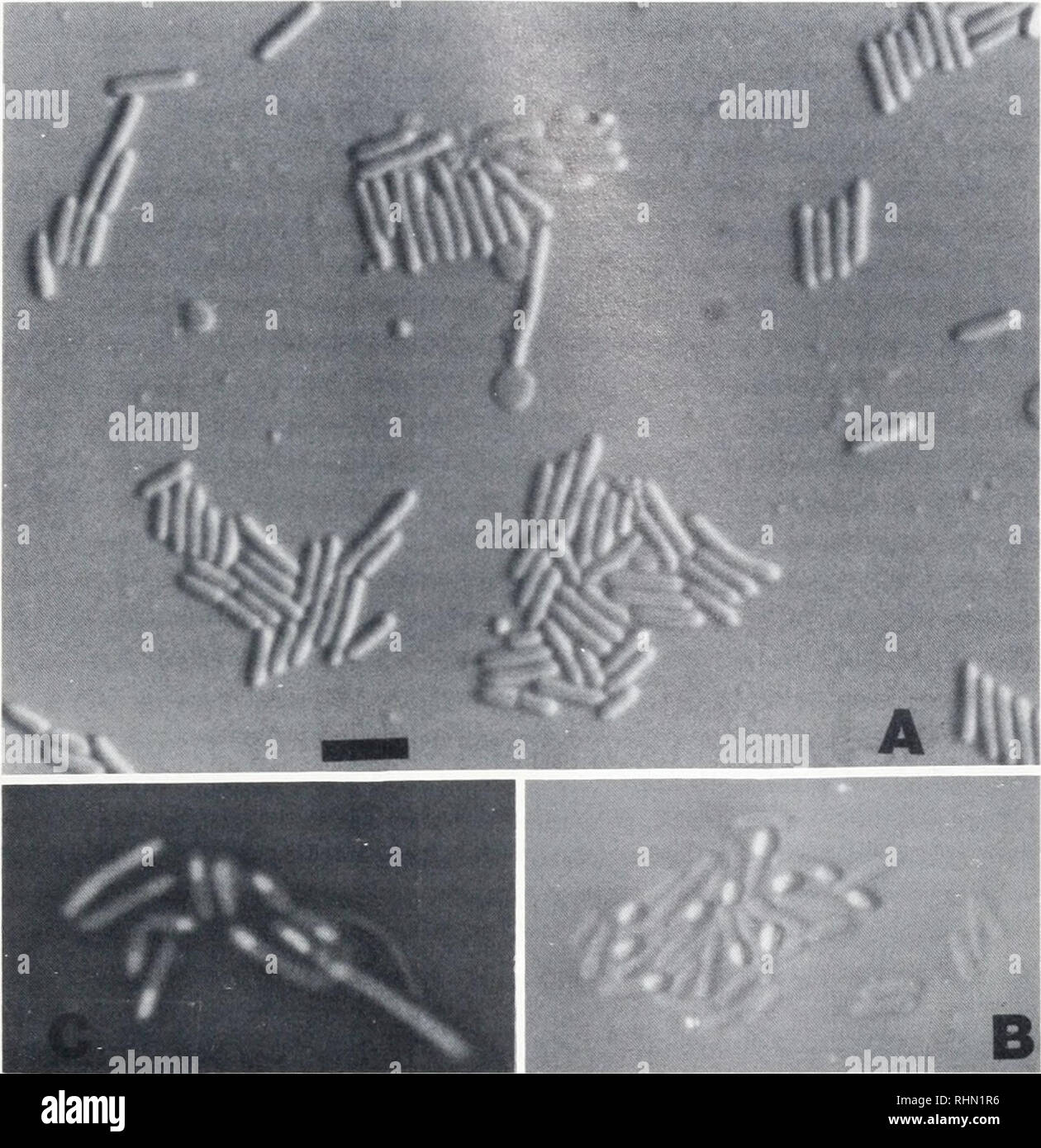 Nomarski microscopy fotografías e imágenes de alta resolución - Alamy