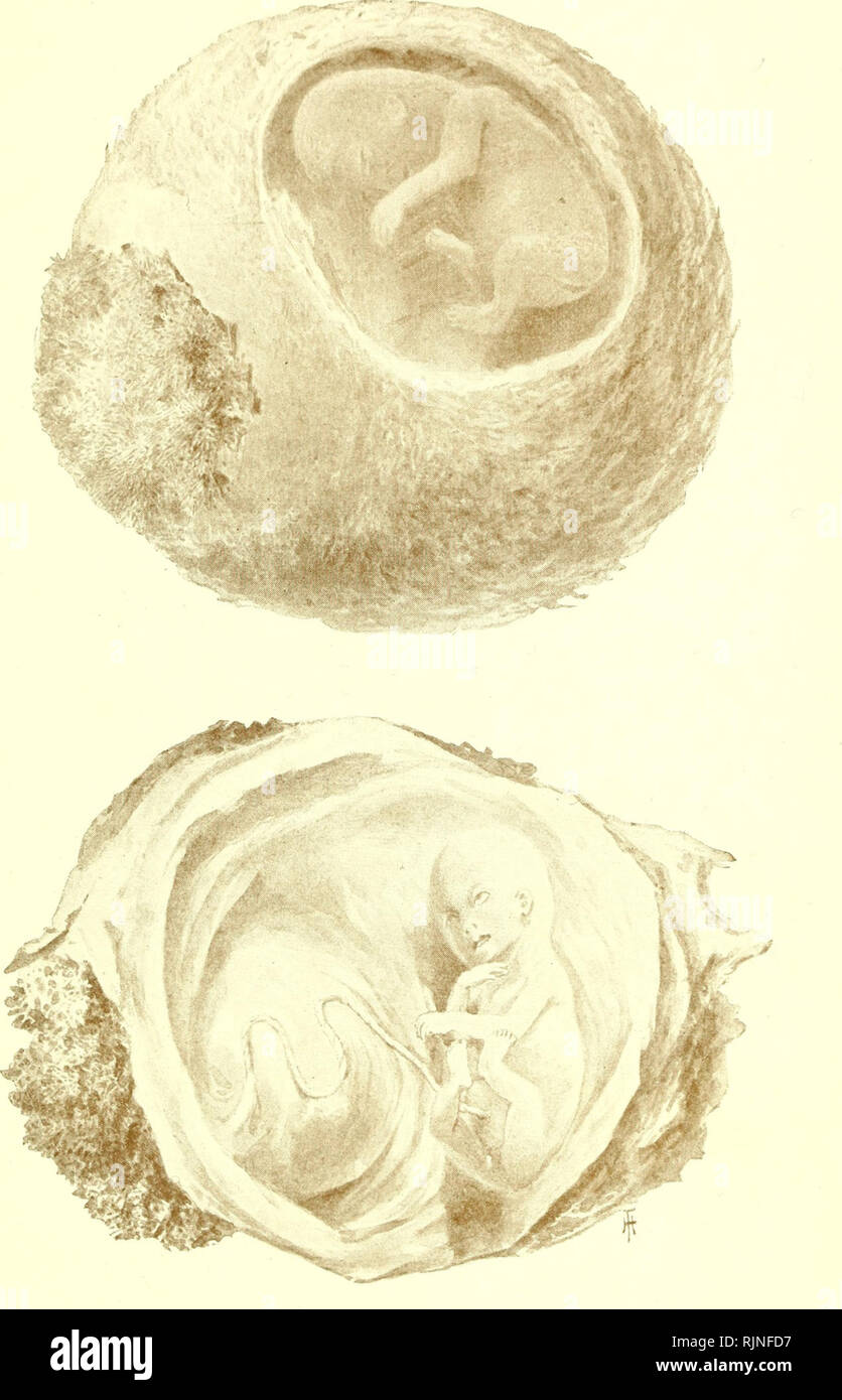 Un Libro De Texto De Embriologia Para Los Estudiantes De Medicina Recurso Electronico Embriologia Embriologia Feto Del Tercer Mes Con Membranas Fetales Y Placenta Recien Formada Nat Tamano De Ural En
