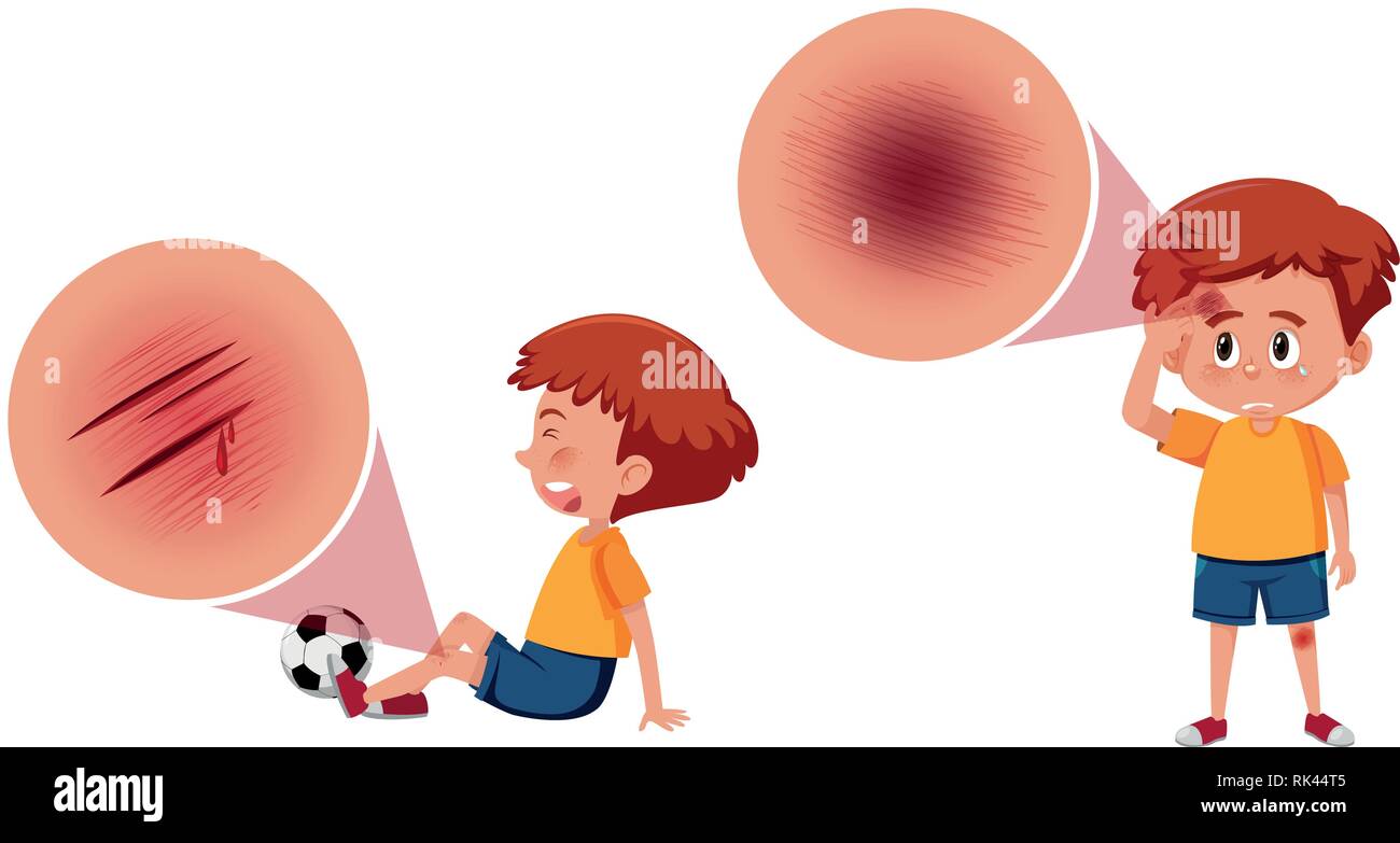 Vectores De Heridas Fotos e Imágenes de stock Alamy