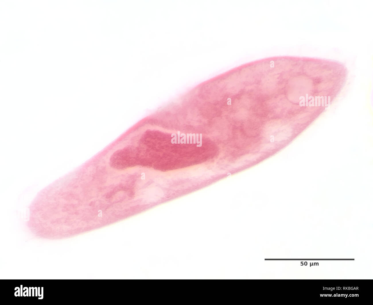 Paramecio caudatum (manchado) bajo el microscopio. Foto de stock