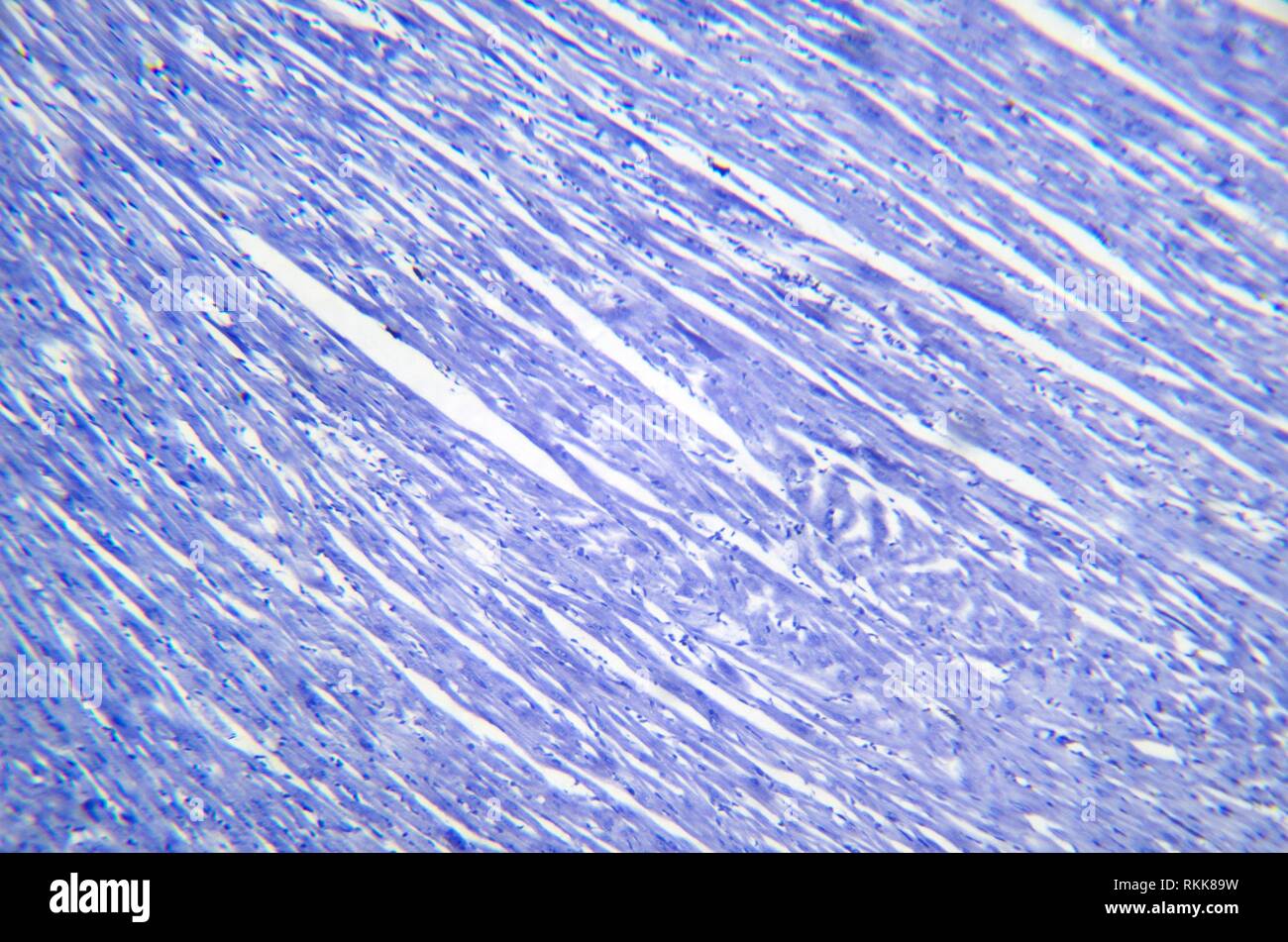 Fotografía de microscopía. Sección del músculo cardíaco. Foto de stock
