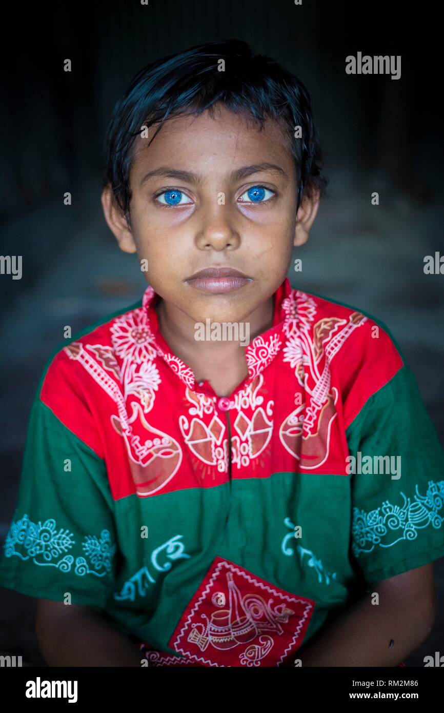 Rizvi, de 8 años, un niño con ojos azules raros en Bangladesh. Foto de stock