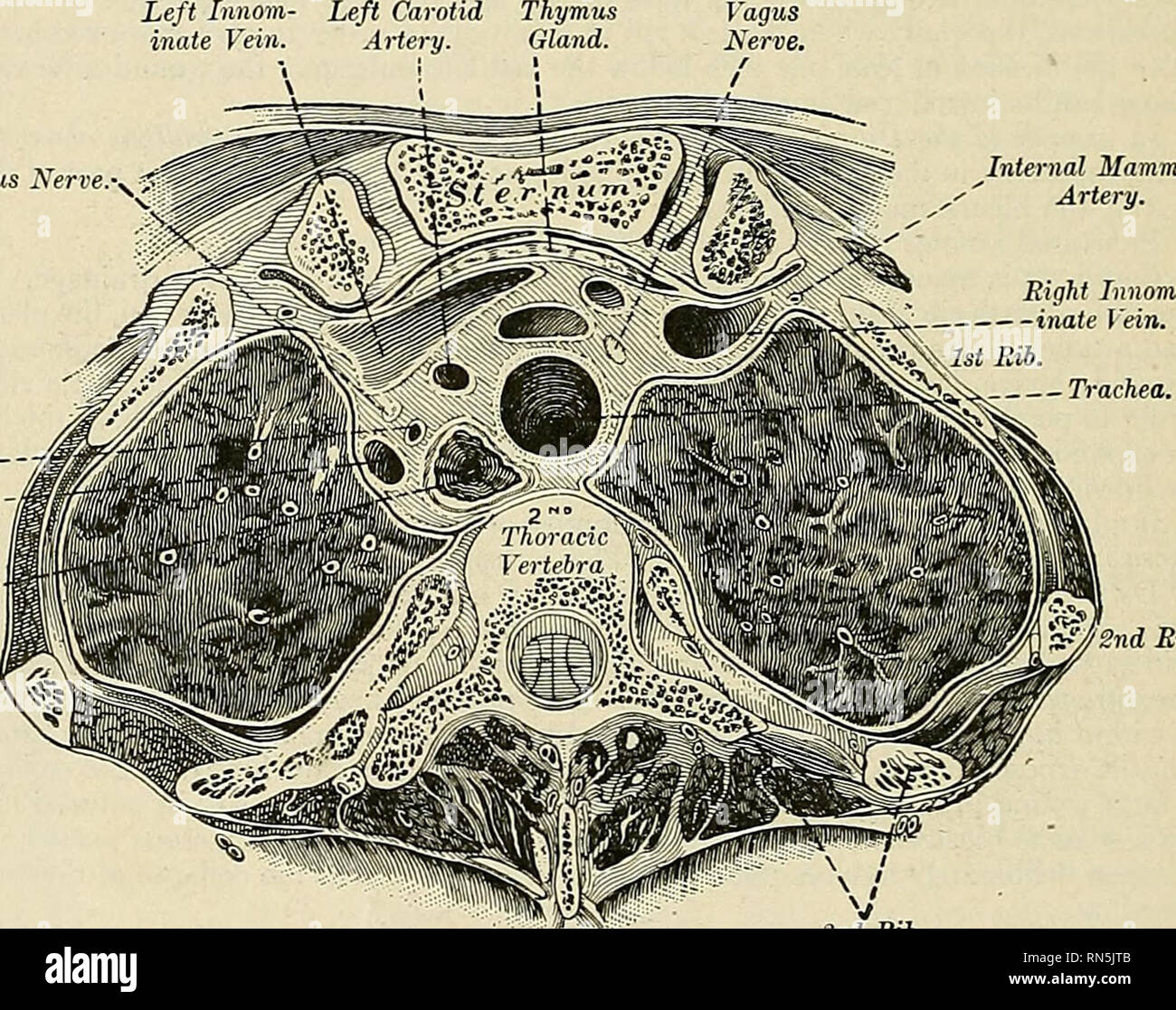 anatomia del mediastino anteriore