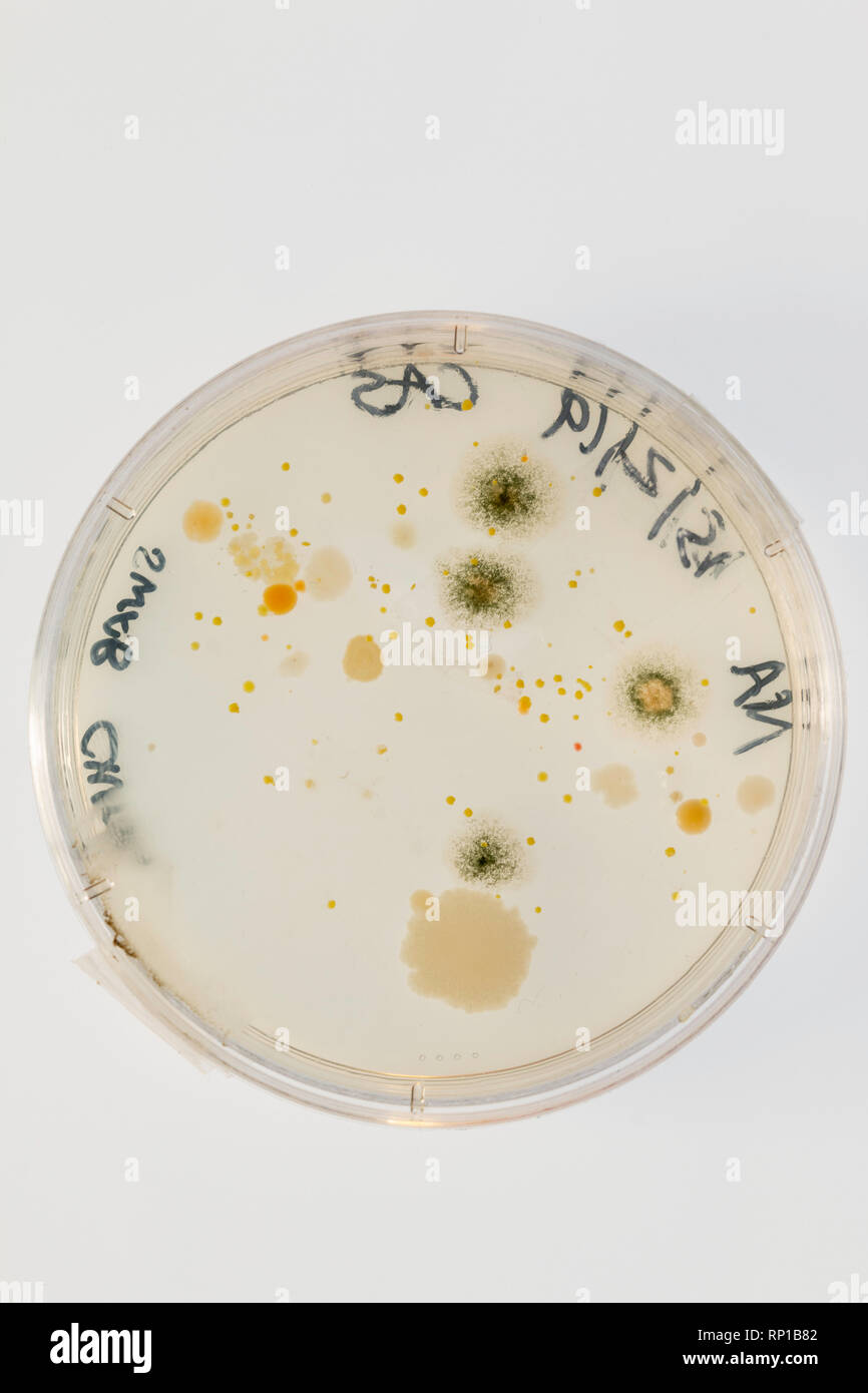 Los microbios crecen en una placa de agar después de tomar un hisopo de una silla escolar Foto de stock