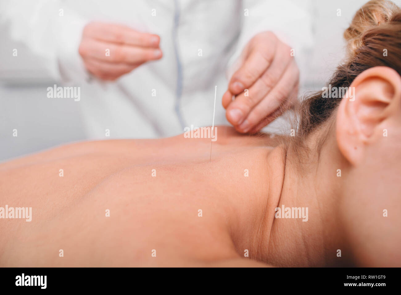 Acupuntor insertando una aguja en la espalda femenina. paciente con tratamiento tradicional china usando agujas para restaurar un flujo de energía a través de spec Foto de stock