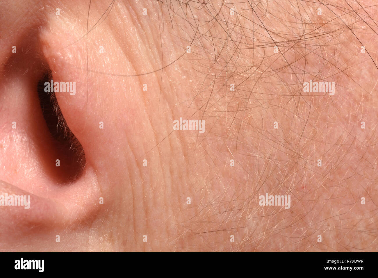Las arrugas debido a la edad en la oreja de una mujer de 43 años Fotografía  de stock - Alamy