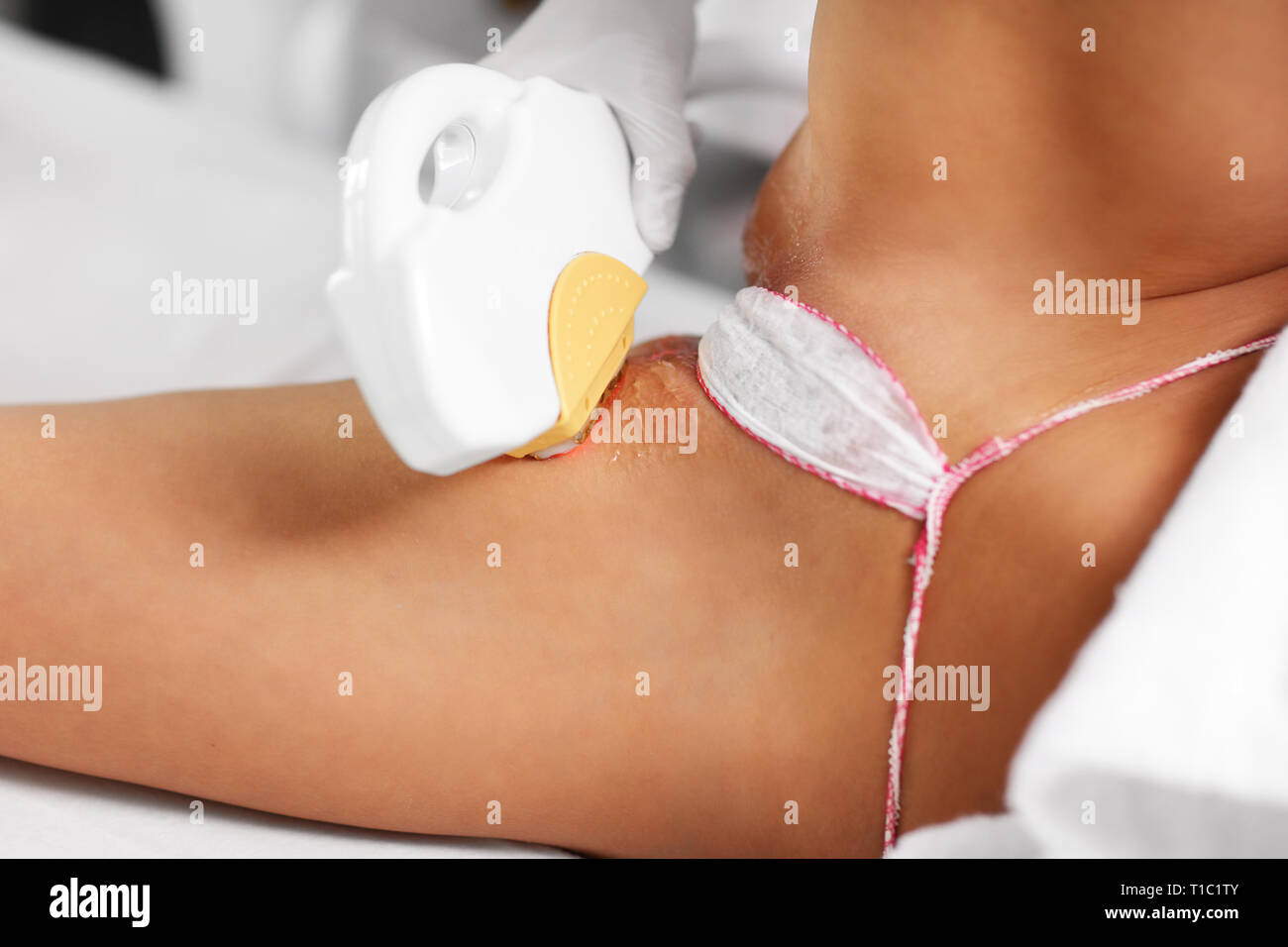 Imagen de la esteticista Depilación Láser dando tratamiento a la mujer en  bikini Fotografía de stock - Alamy