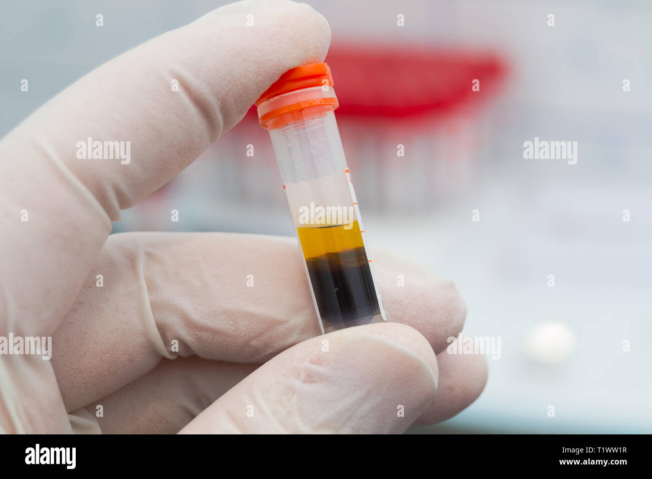 Scientist sosteniendo en su mano una muestra de sangre centrifugada con  hemólisis Fotografía de stock - Alamy