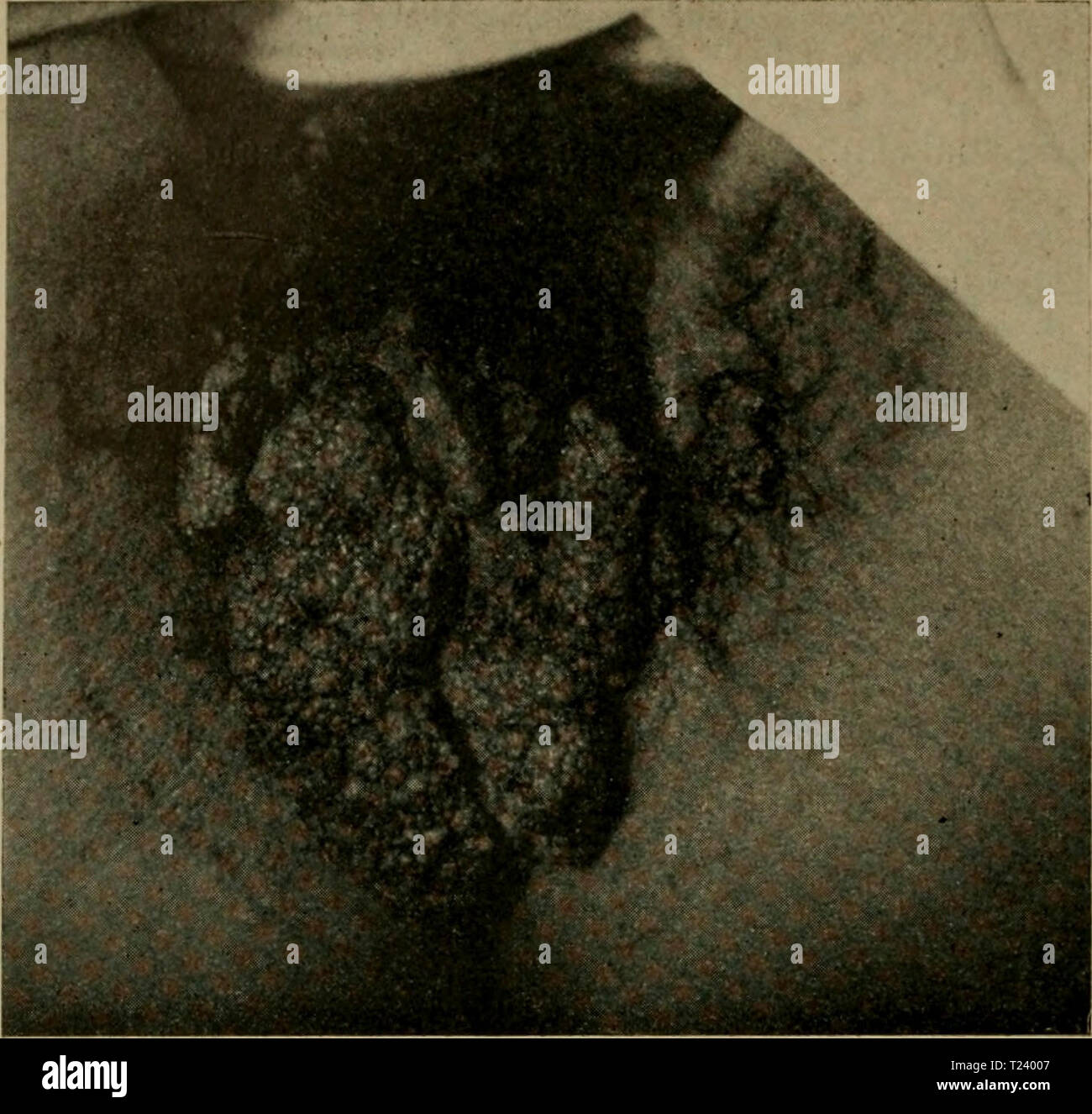 Imagen de archivo de la página 393 de Die vergleichende Pathologie der Haut Foto de stock