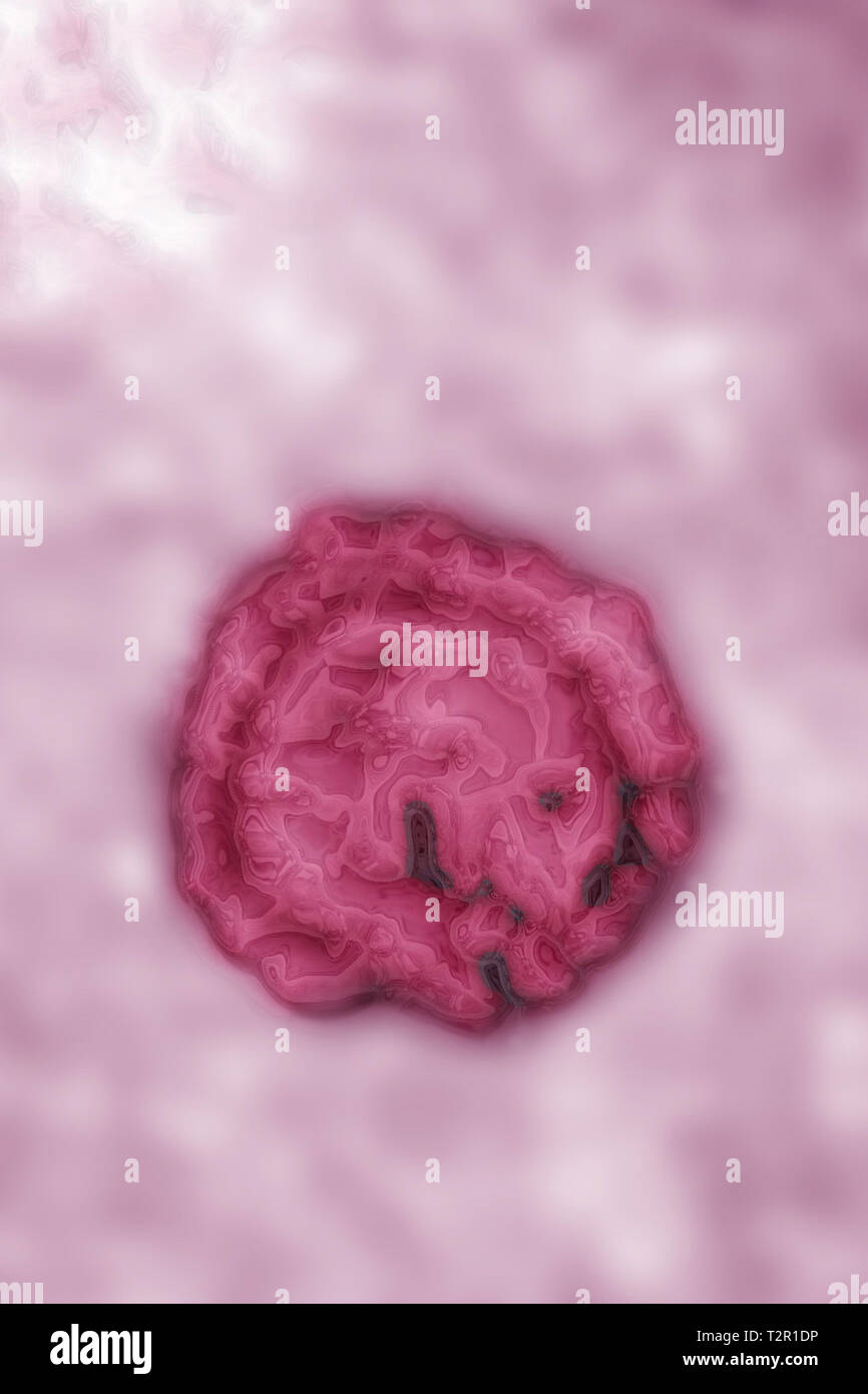 El virus de la hepatitis B Foto de stock