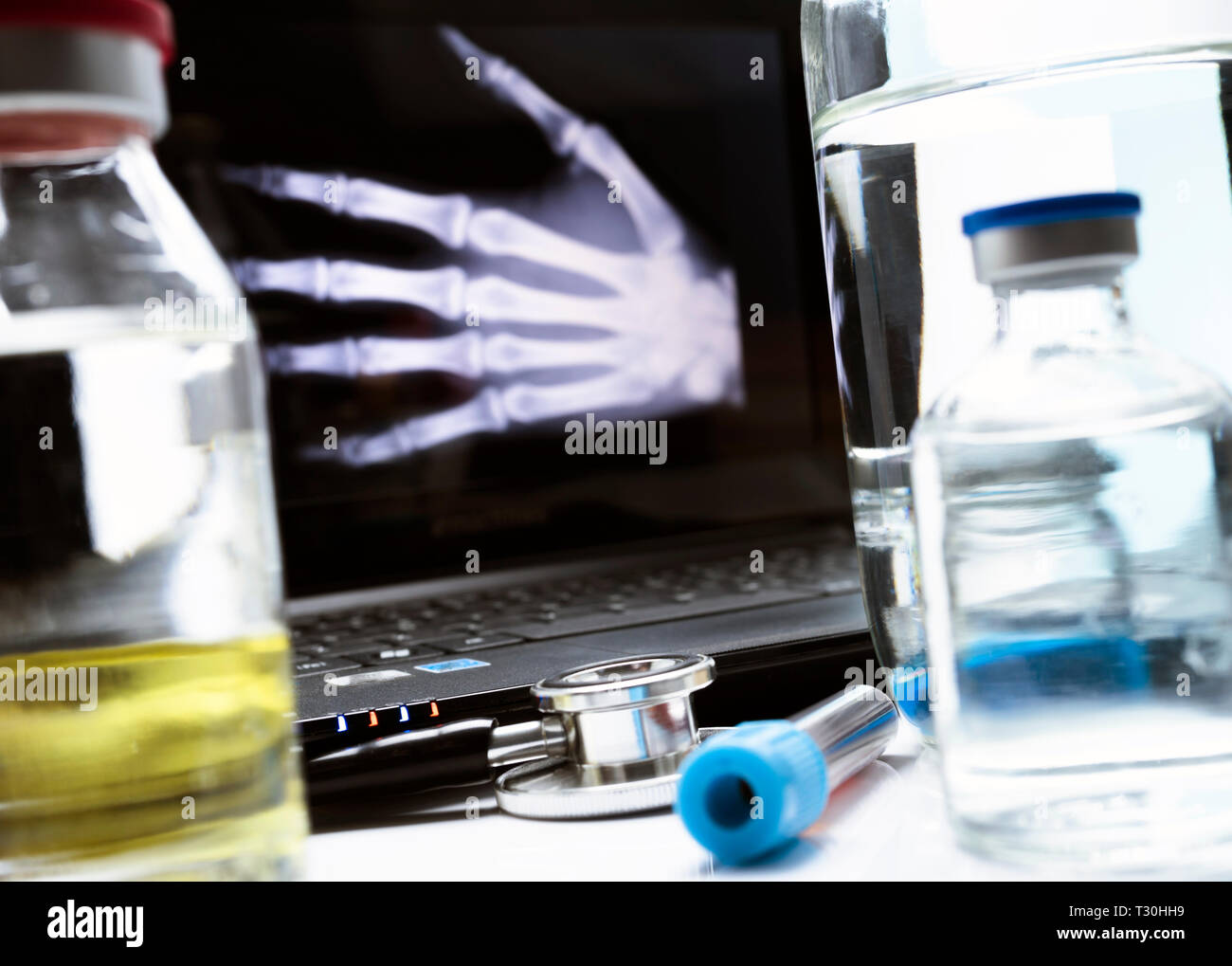 La radiografía de la mano en el hospital, imagen conceptual Foto de stock