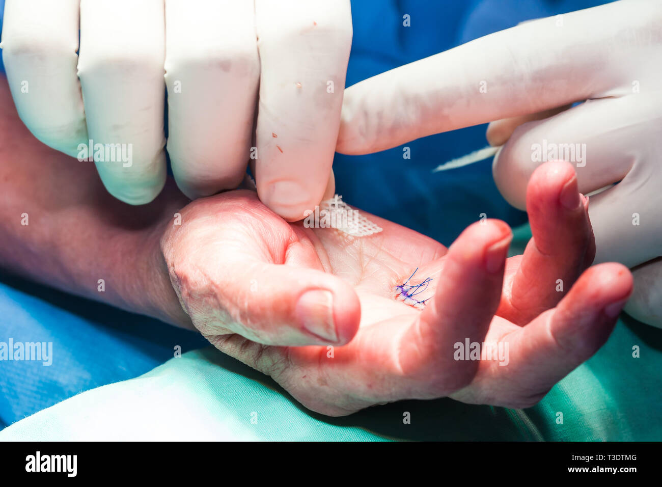 Vendaje De Mano Fotos e Imágenes de stock - Alamy