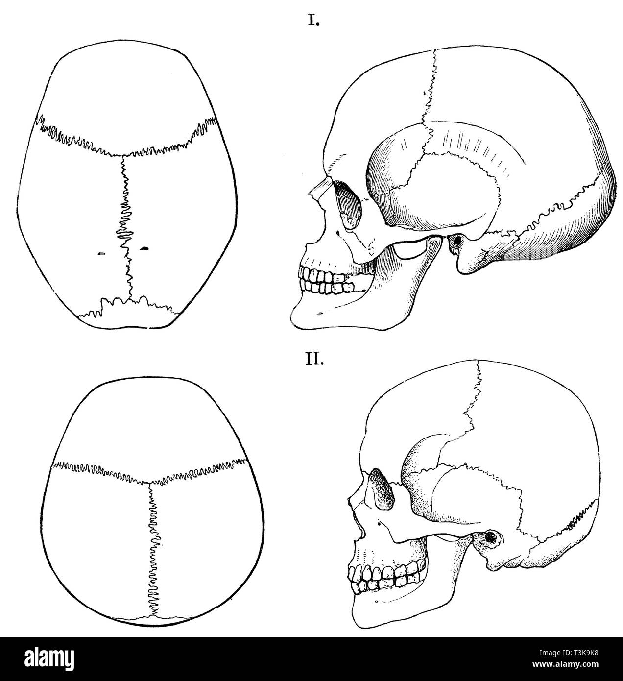 Cráneo humano: las formas de los dos tipos humanos que conforman la  población actual de Württemberg. I) moderadamente oblicua de cabeza larga,  de Stuttgart, ii) la cabeza recta corta, desde el Bosque