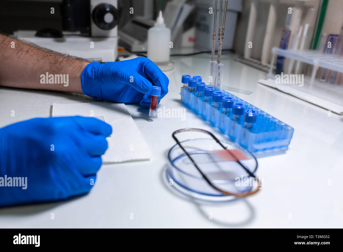 Scientist preparar muestra de sangre para la investigación sobre el microscopio. Colocar muestra de sangre en el portaobjetos del microscopio. Foto de stock