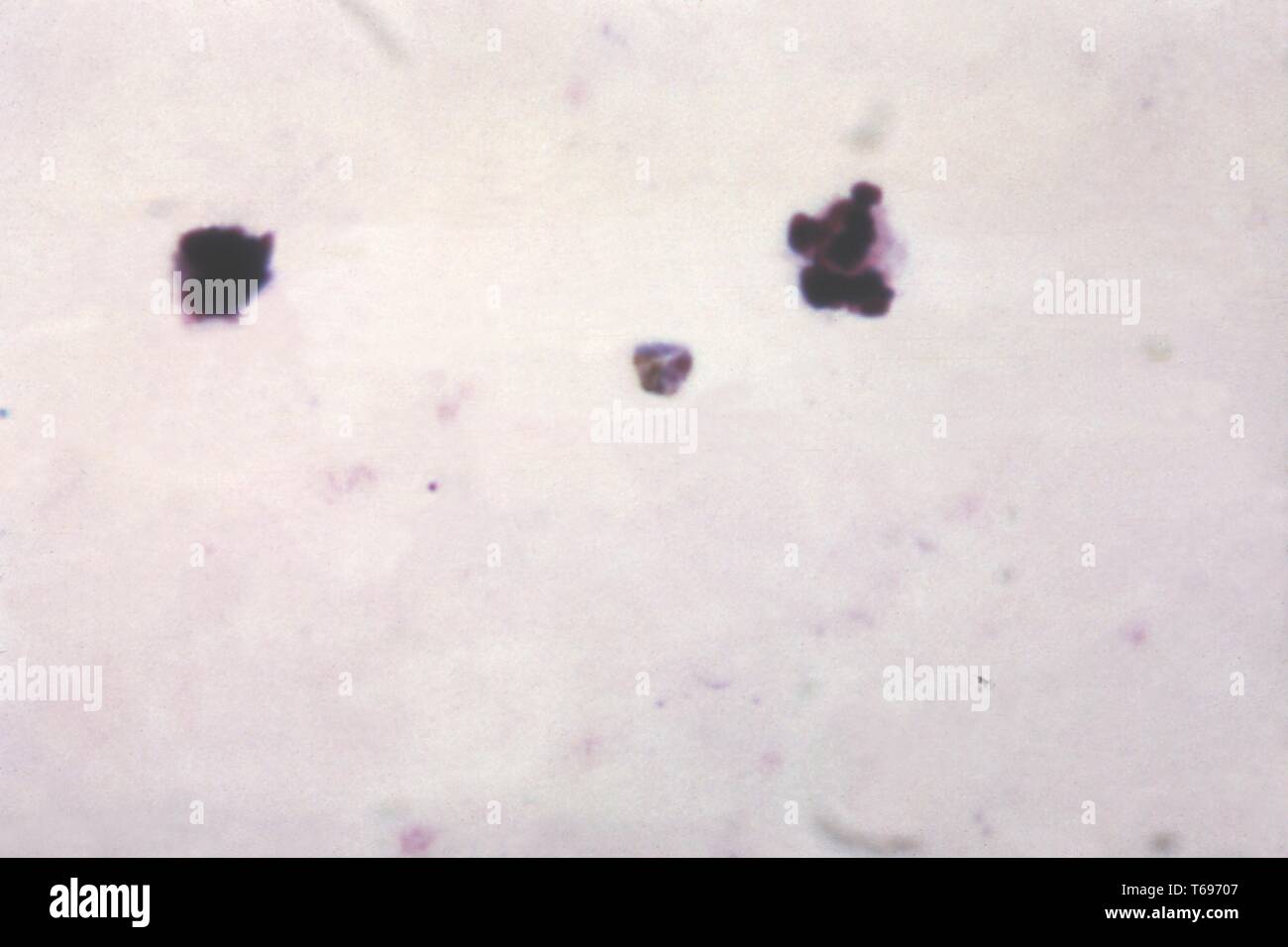 Microfotografía De Película Gruesa De Un Viejo Creciente Plasmodium Malariae Trofozoitos 0030