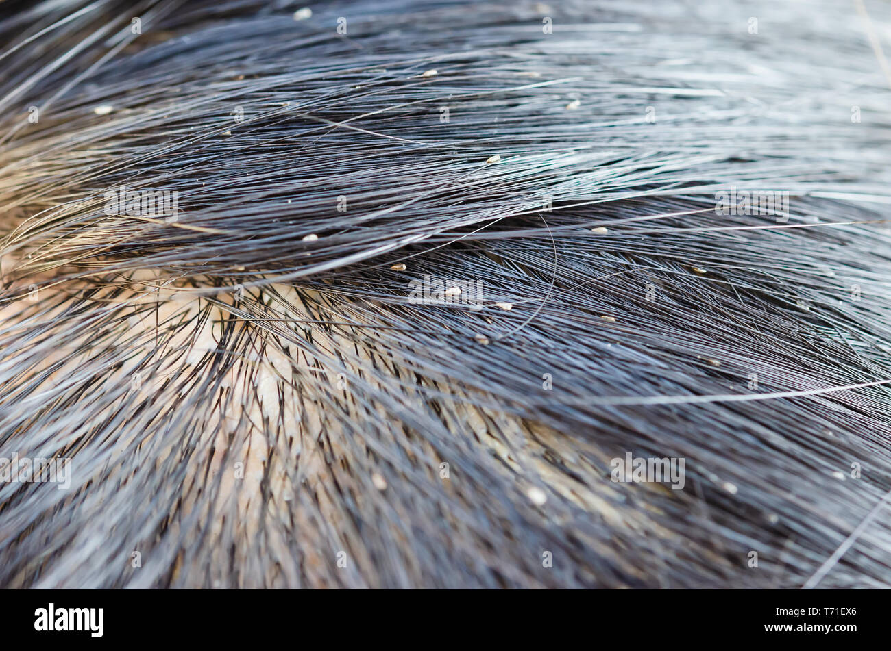 pulmón Pacífico Zanahoria Huevos de piojos en el cabello provoca picazón en la cabeza Fotografía de  stock - Alamy