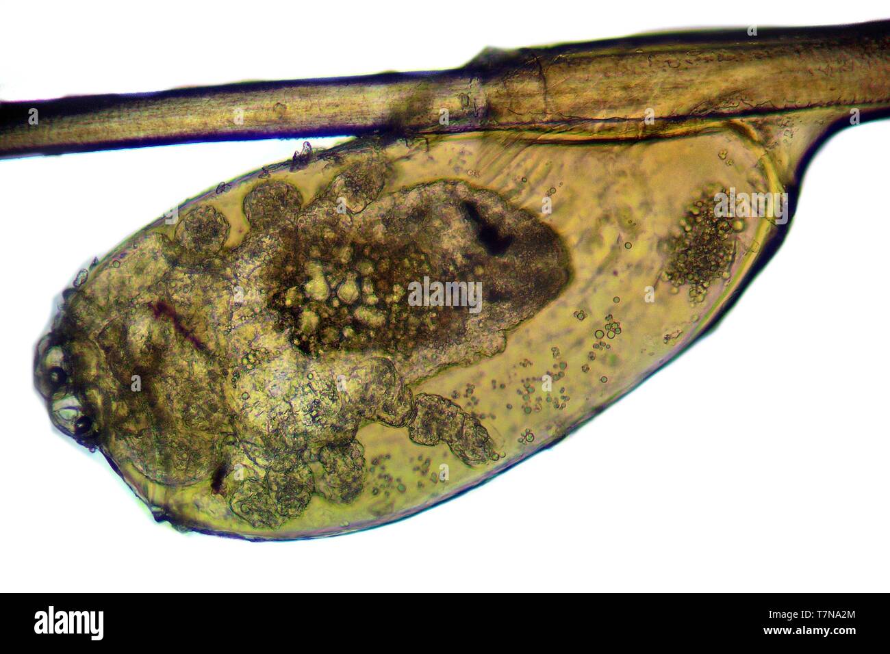 Piojo de la cabeza (Pediculus capitis, Imagen de microscopio, la sangre  dentro de su cuerpo Fotografía de stock - Alamy