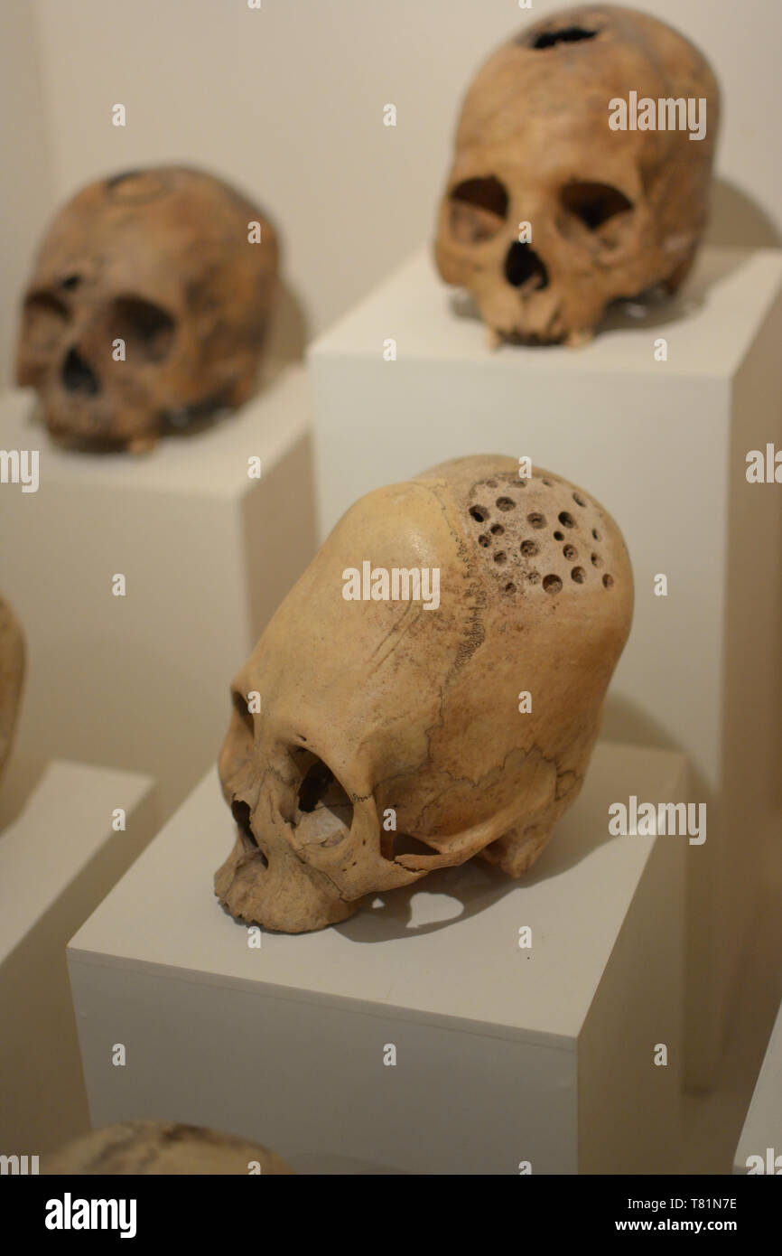 Cráneos alargados del antiguo pueblo de Paracas Foto de stock