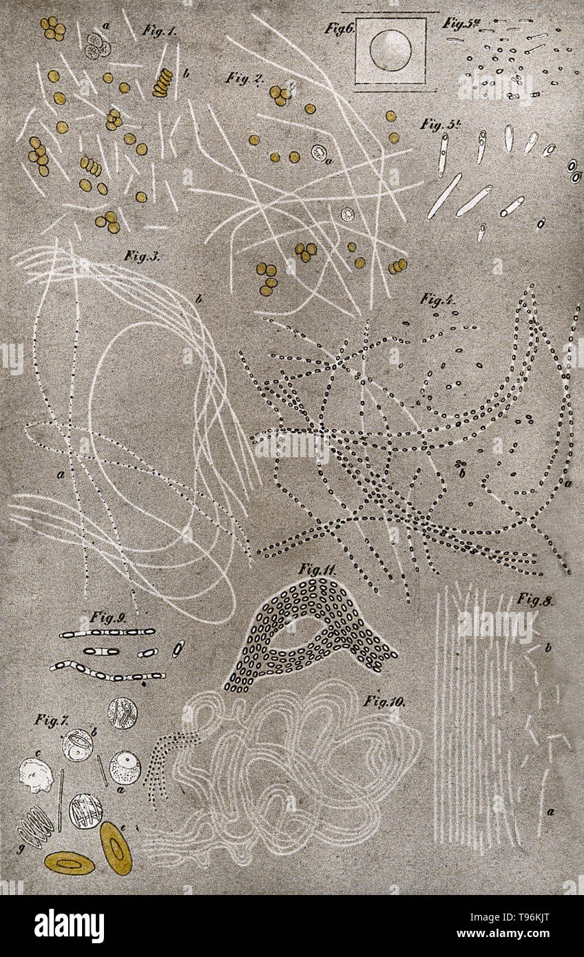 El bacilo del ántrax: diez ejemplos, visto a través de un microscopio. En el papel de Robert Koch. Figs 1-3 el bacilo del ántrax filiforme. Fig. 4 Formación de esporas de ántrax. Fig. 7-11 Bacillus subtilis magnificación 900 utilizando una lente de inmersión de Seibert VI. Heinrich Hermann Robert Koch (11 de diciembre de 1843 - 27 de mayo de 1910) fue un médico alemán y el microbiólogo. Foto de stock