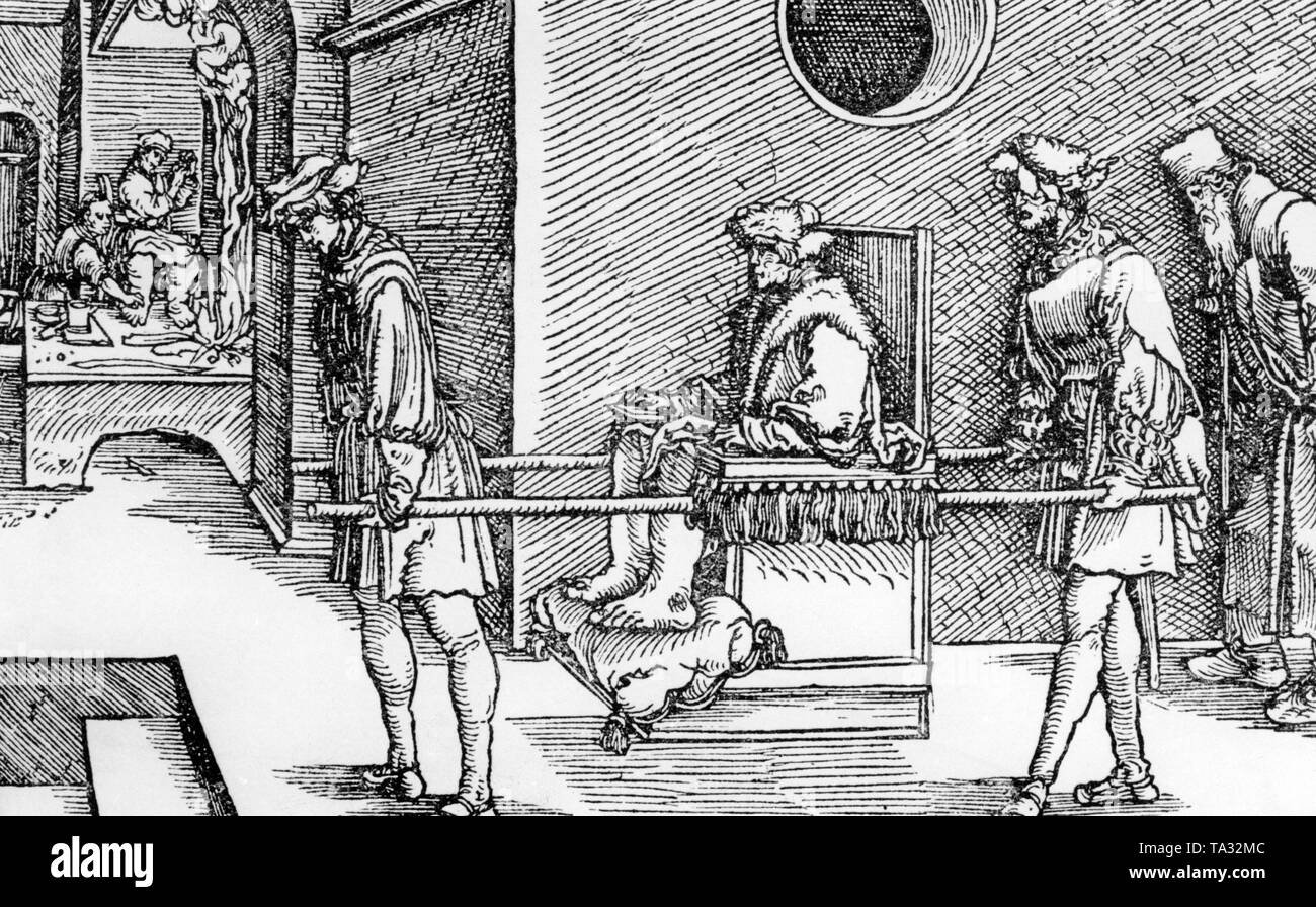 El dibujo por Hans Burgkmaier ilustra una gota sufriente, que está siendo llevado a su médico. Foto de stock