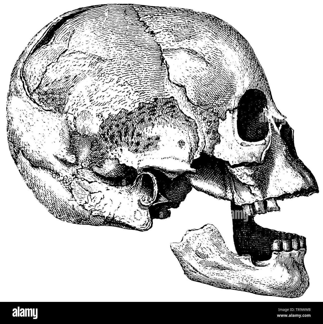 Monumentos de la edad de hielo, la edad de la piedra; tipo de cráneo prehistórico, , (libro de historia cultural, 1875) Foto de stock