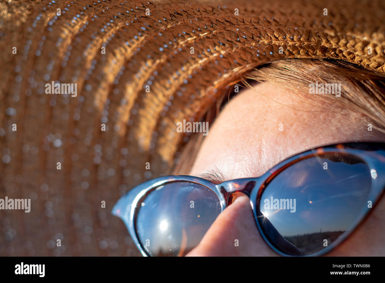 La frente de una mujer con pecas en la luz solar directa, vista cercana. Protección UV, radiación solar concepto: piel con lentigo en el sol del verano Foto de stock