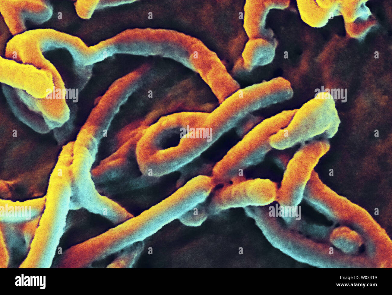 Este Instituto Nacional de Alergias y Enfermedades Infecciosas (NIAID) imagen tomada el 12 de agosto de 2014 utilizando un coloreado digitalmente análisis micrografía de electrones (SEM), muestra una sola partícula de virus Ebola filamentosas. La fiebre hemorrágica del Ébola Ébola (HF) es una de las numerosas las fiebres hemorrágicas víricas. Se trata de una grave, a menudo mortal enfermedad en humanos y en primates no humanos. UPI/NIAID Foto de stock