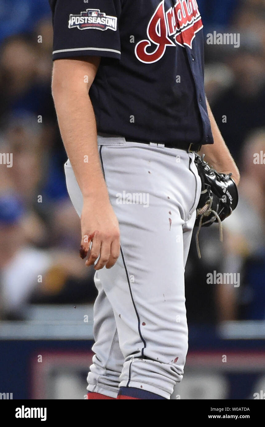 MLB: Lanzador de los Cleveland Indians se fracturó un dedo mientras se  cambiaba de ropa