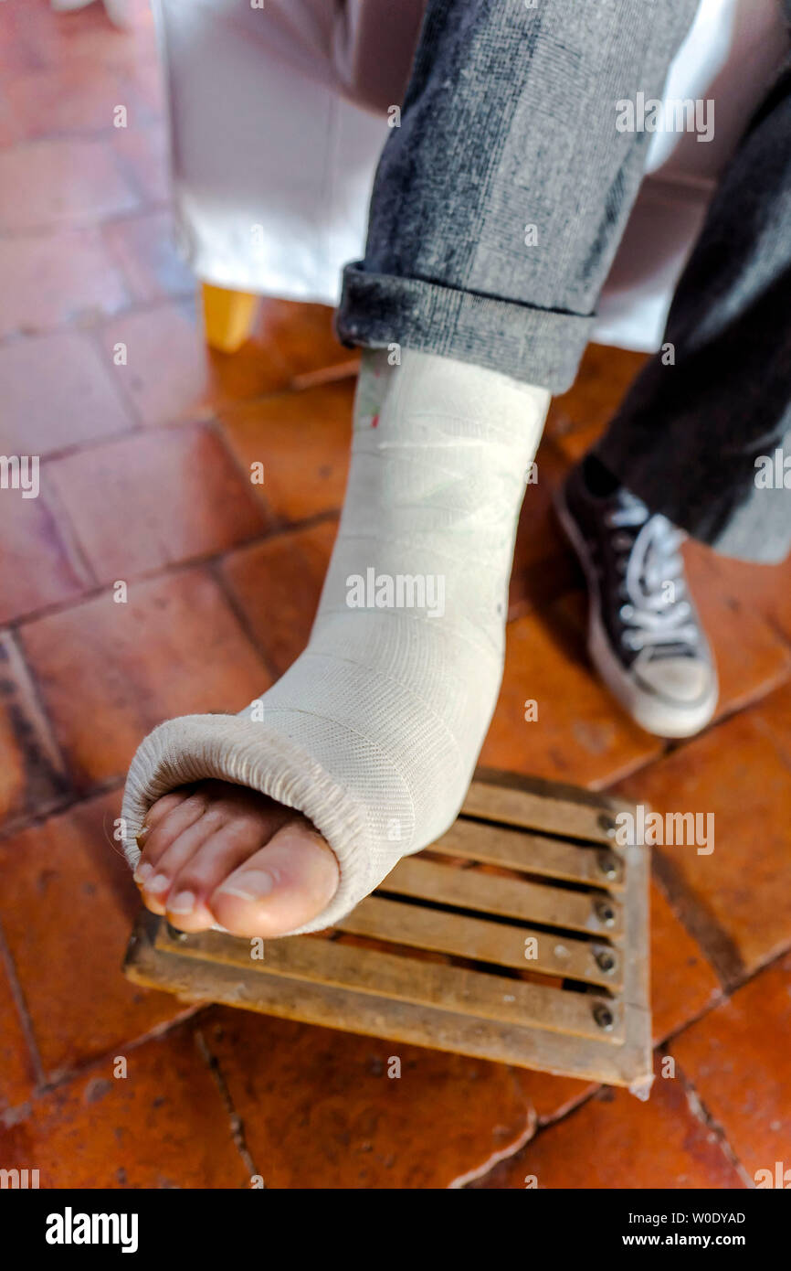 Mujeres con el pie quebrado fotografías e imágenes de alta resolución