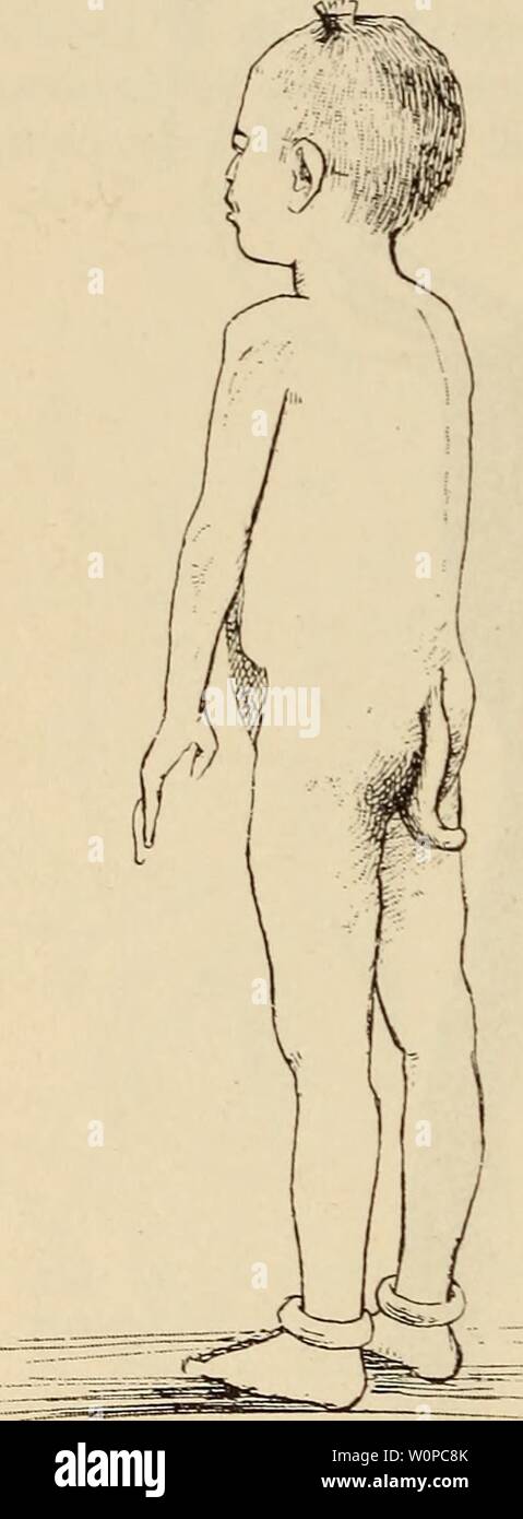 Imagen de archivo de la página 41 del Der Bau des Menschen als. Der Bau des  Menschen Zeugnis als für seine Vergangenheit derbaudesmensche00wied Año:  1902 30 Skelettsystem. nähme angefertigte Abbildung. Eine davon