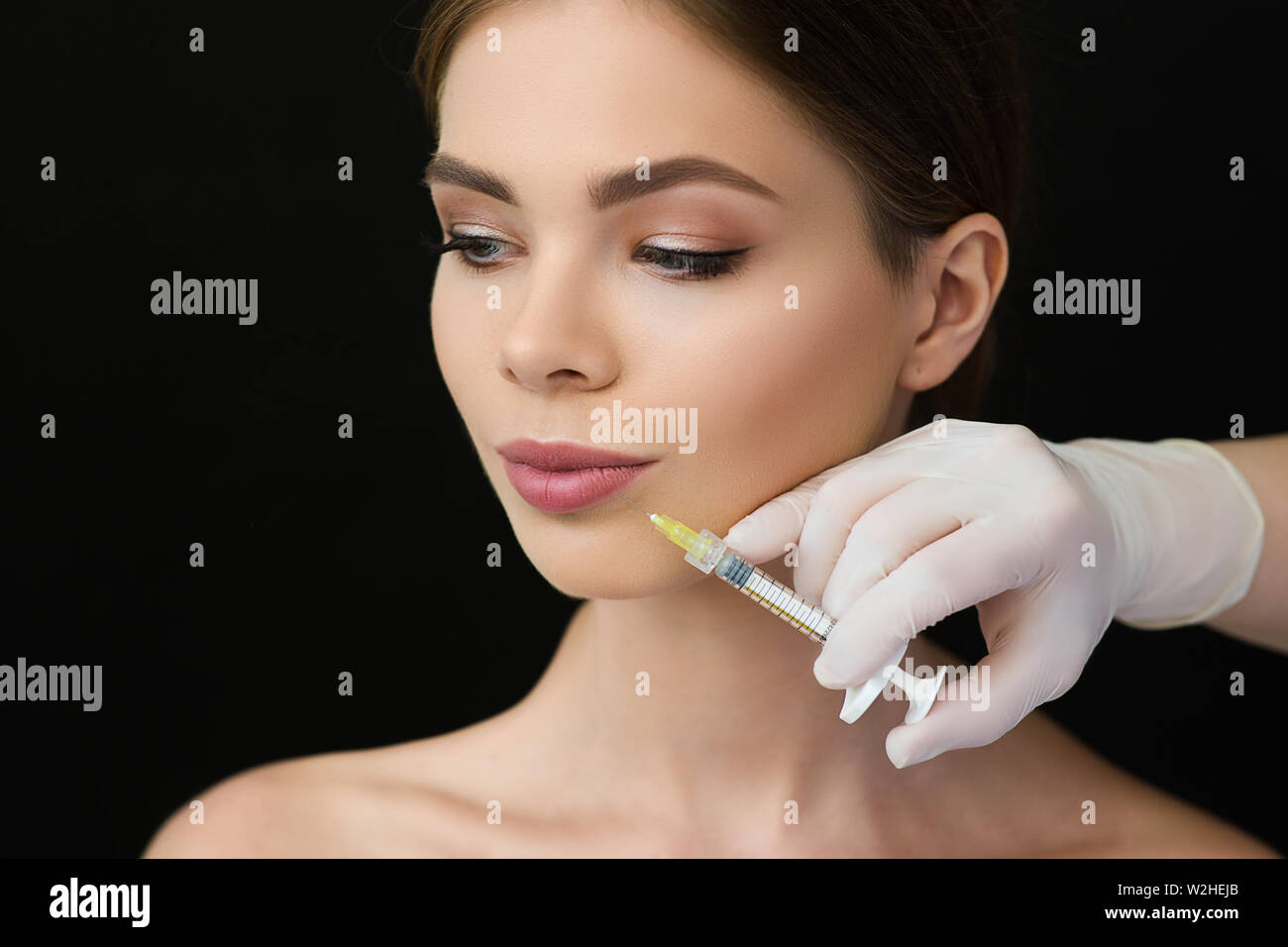 Aumento de labios fotografías e imágenes de alta resolución - Alamy