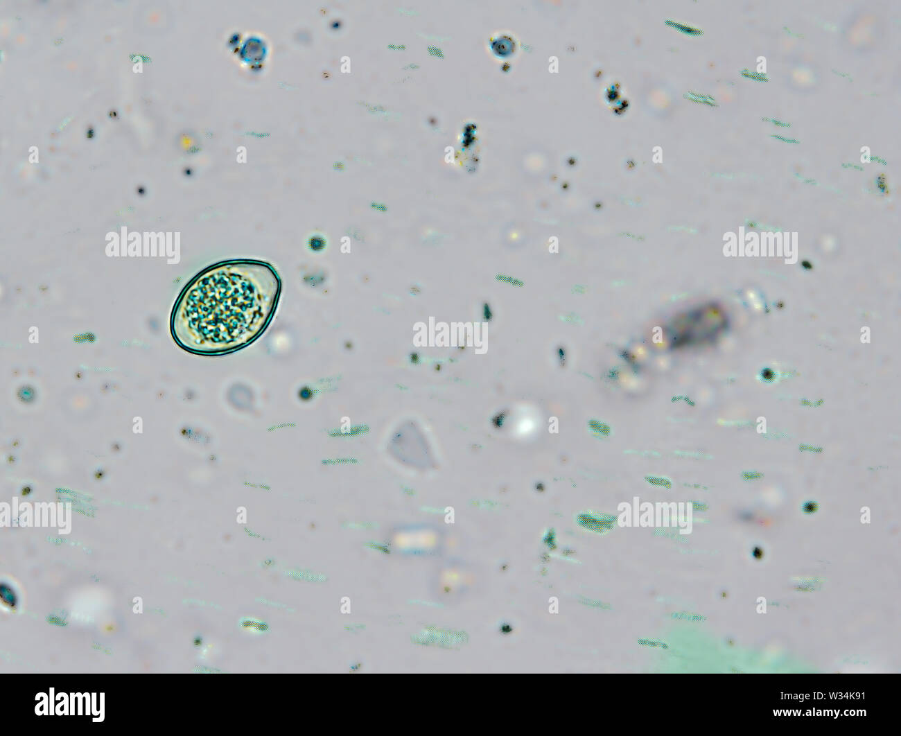 Los ooquistes de Isospora spp., heces de gato bajo el microscopio  Fotografía de stock - Alamy