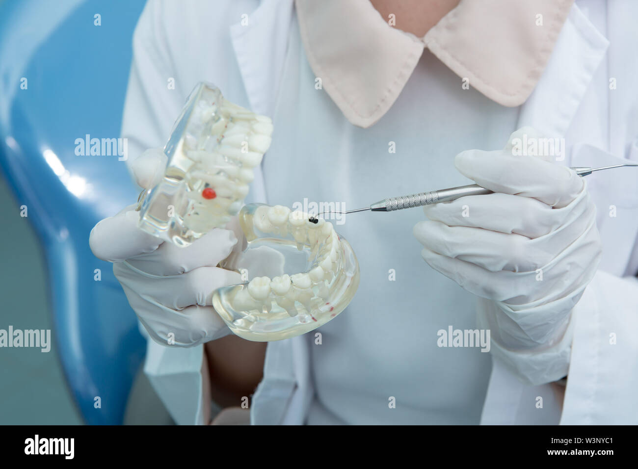 Dentista con guantes mostrando las caries en los dientes modelo Foto de stock