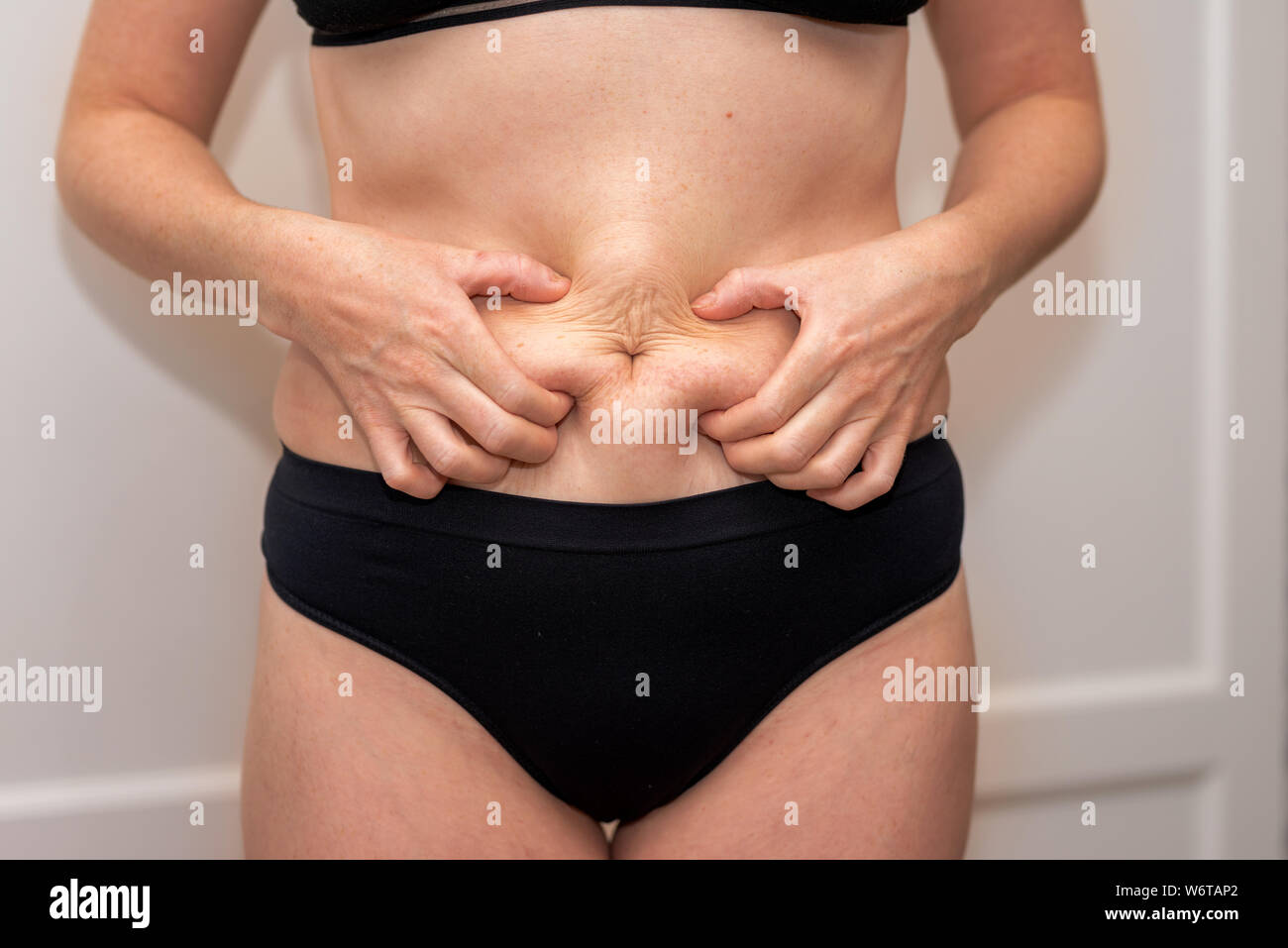 La grasa del vientre femenino, mujer sosteniendo su piel para controlar la celulitis. Deshacerse de la grasa abdominal y pérdida de peso. La mujer vista frontal del vientre de grasa corporal Foto de stock