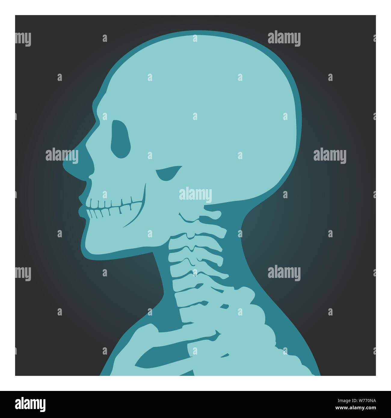 Toma de rayos X del cráneo, el cuerpo humano, los huesos de la cabeza y el cuello, radiografía, vista lateral de la ilustración vectorial. Ilustración del Vector