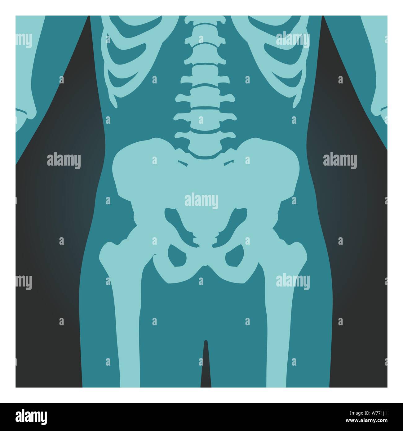 Toma de rayos X de la pelvis y la columna vertebral, los huesos del cuerpo humano, radiografía, ilustración vectorial. Ilustración del Vector