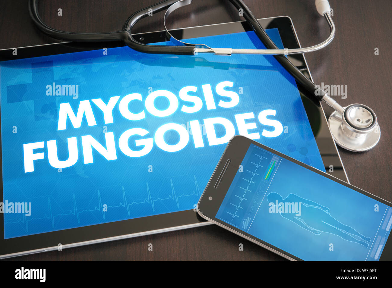 Micosis fungoide (tipo de cáncer) Concepto de diagnóstico médico en la pantalla de Tablet PC con el estetoscopio. Foto de stock